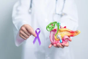 Early Signs of Pancreatic Cancer You Should Not Ignore